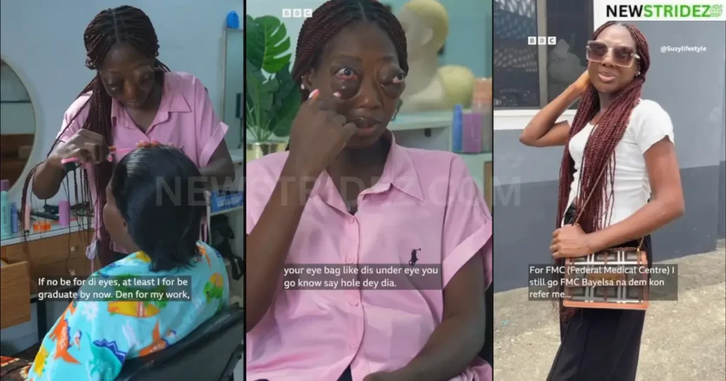 “‘She refused to give up’ — Video of Nigerian lady battling rare illness trends online, sparks emotional reactions”-Credit: bbcnewspidgin Source: IG